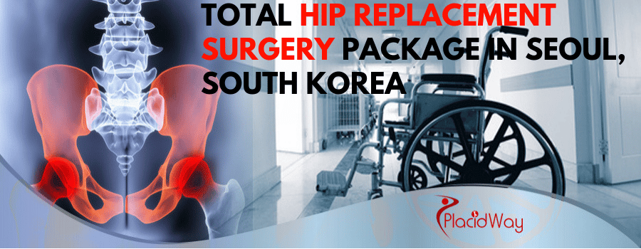 Total Hip Replacement Surgery Package in Seoul, South Korea Cost